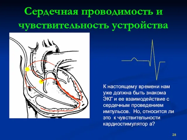 Сердечная проводимость и чувствительность устройства К настоящему времени нам уже должна быть