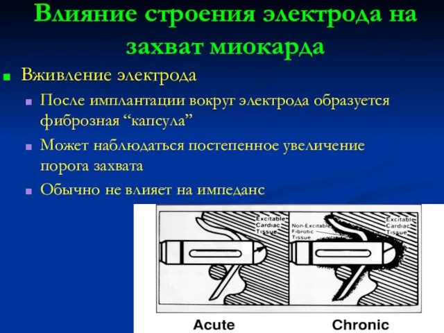 Влияние строения электрода на захват миокарда Вживление электрода После имплантации вокруг электрода