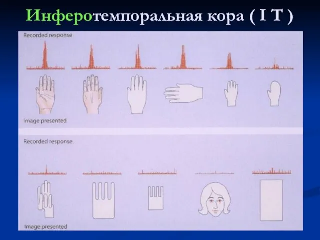 Инферотемпоральная кора ( I T )