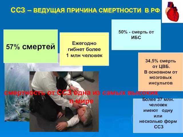 ССЗ – ВЕДУЩАЯ ПРИЧИНА СМЕРТНОСТИ В РФ 57% смертей Ежегодно гибнет более