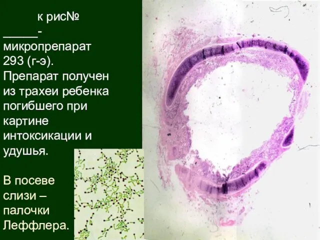 к рис№ _____-микропрепарат 293 (г-э). Препарат получен из трахеи ребенка погибшего при