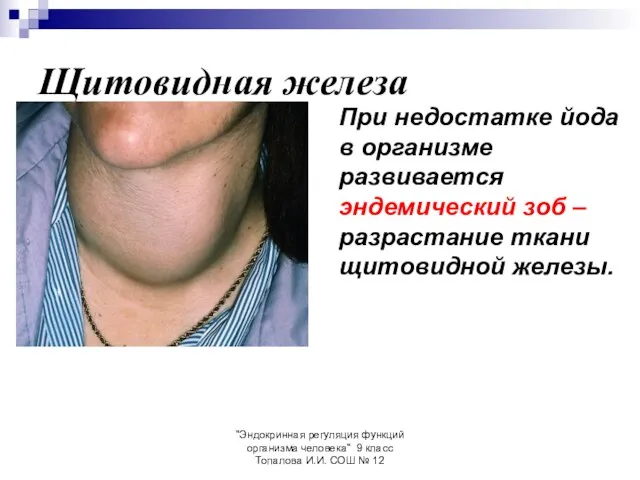 "Эндокринная регуляция функций организма человека" 9 класс Топалова И.И. СОШ № 12