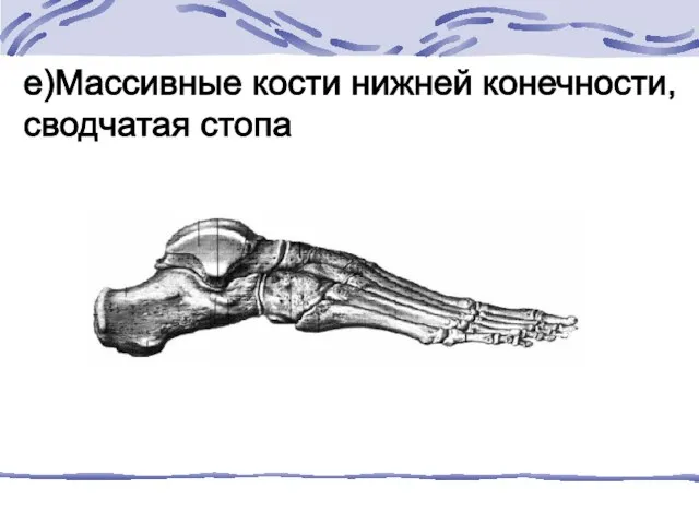 е)Массивные кости нижней конечности, сводчатая стопа