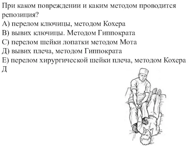 При каком повреждении и каким методом проводится репозиция? А) перелом ключицы, методом