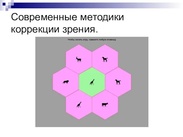 Современные методики коррекции зрения.