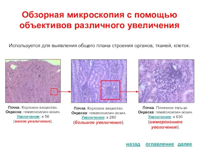 Обзорная микроскопия с помощью объективов различного увеличения оглавление назад Почка. Корковое вещество.