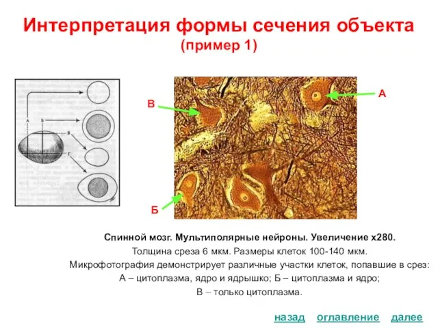 Интерпретация формы сечения объекта (пример 1) Спинной мозг. Мультиполярные нейроны. Увеличение х280.