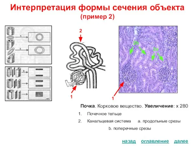 Интерпретация формы сечения объекта (пример 2) Почка. Корковое вещество. Увеличение: х 280