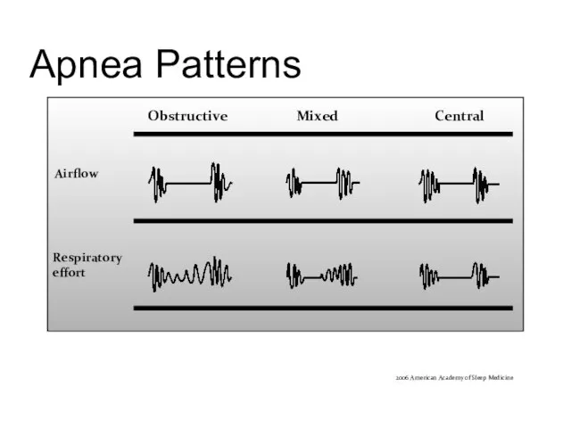 Apnea Patterns Airflow Respiratory effort 2006 American Academy of Sleep Medicine