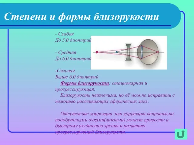 Степени и формы близорукости - Слабая До 3,0 диоптрий - Средняя До