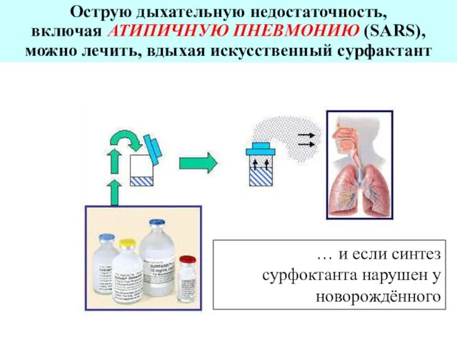 Оcтрую дыхательную недостаточность, включая АТИПИЧНУЮ ПНЕВМОНИЮ (SARS), можно лечить, вдыхая искусственный сурфактант