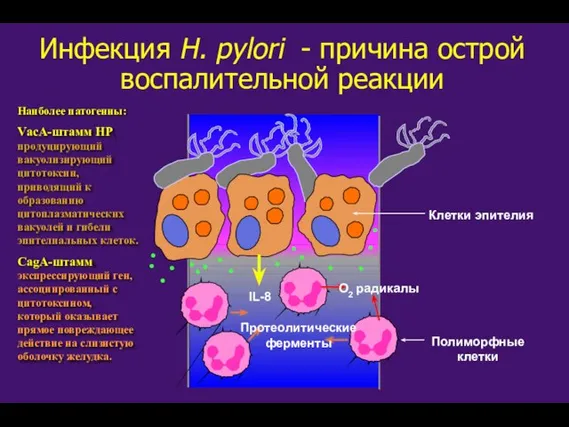 IL-8 Протеолитические ферменты O2 радикалы Инфекция H. pylori - причина острой воспалительной