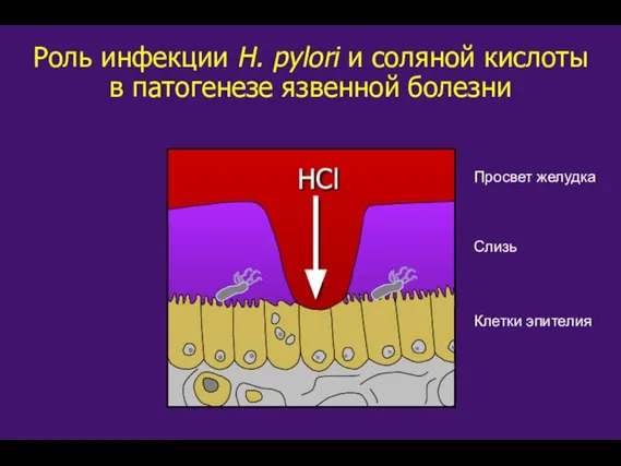 Роль инфекции H. pylori и соляной кислоты в патогенезе язвенной болезни Клетки