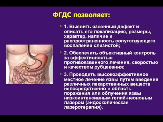 ФГДС позволяет: 1. Выявить язвенный дефект и описать его локализацию, размеры, характер,