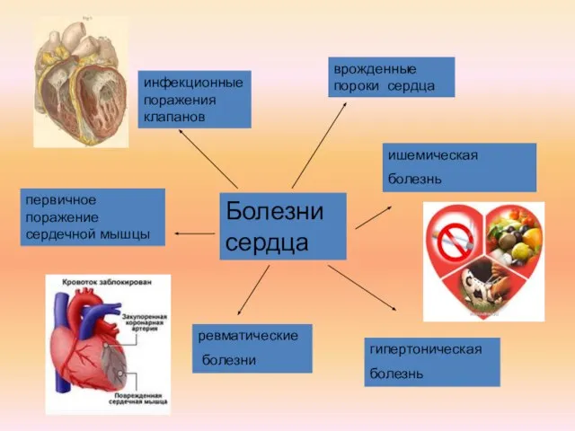 Болезни сердца врожденные пороки сердца ревматические болезни ишемическая болезнь гипертоническая болезнь инфекционные