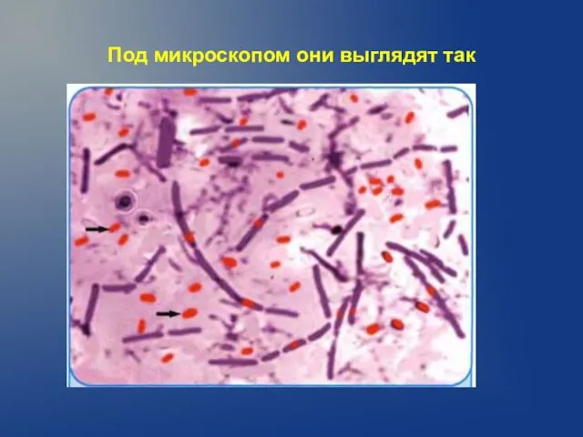 Под микроскопом они выглядят так