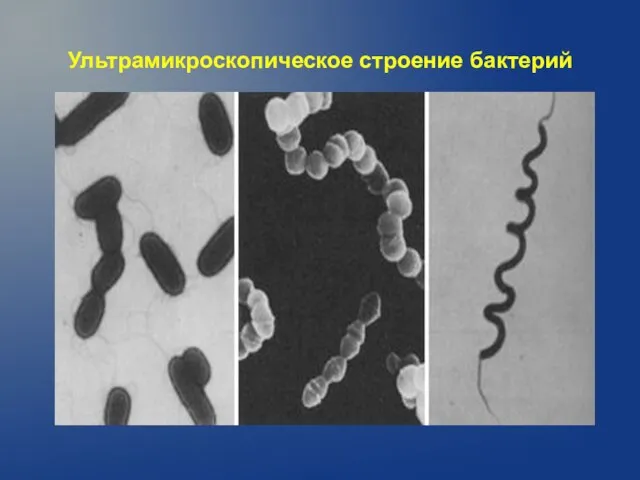 Ультрамикроскопическое строение бактерий