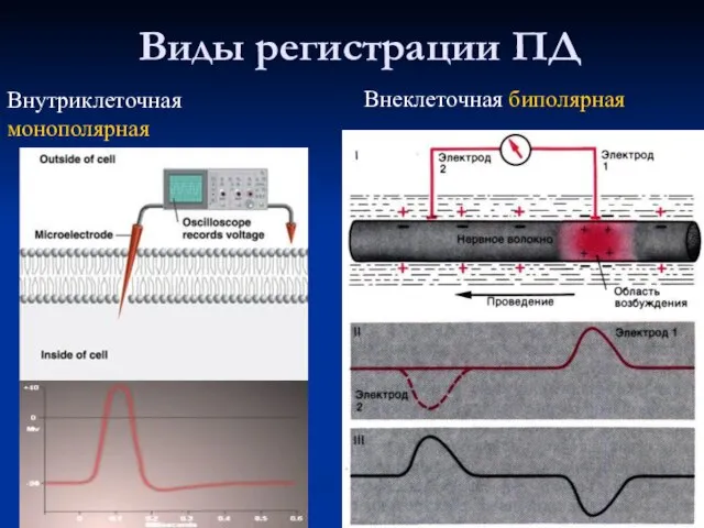 Виды регистрации ПД Внутриклеточная монополярная Внеклеточная биполярная