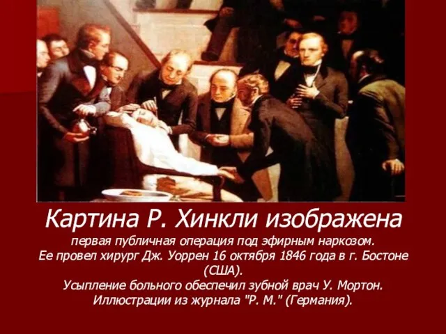 Картина Р. Хинкли изображена первая публичная операция под эфирным наркозом. Ее провел