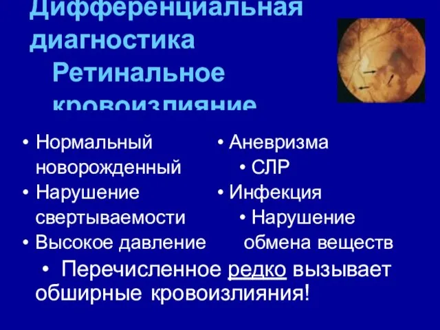 Дифференциальная диагностика Ретинальное кровоизлияние Нормальный • Аневризма новорожденный • СЛР Нарушение •