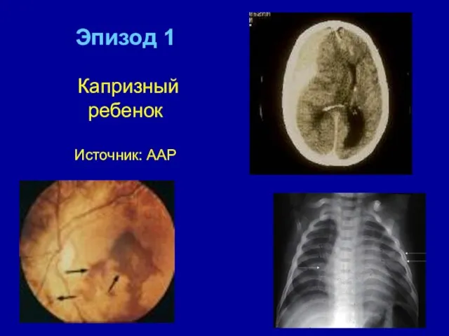 Эпизод 1 Капризный ребенок Источник: AAP