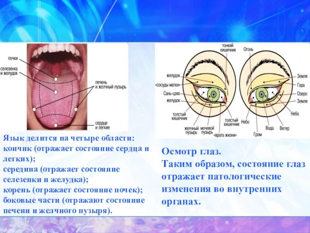 Осмотр глаз. Таким образом, состояние глаз отражает патологические изменения во внутренних органах.