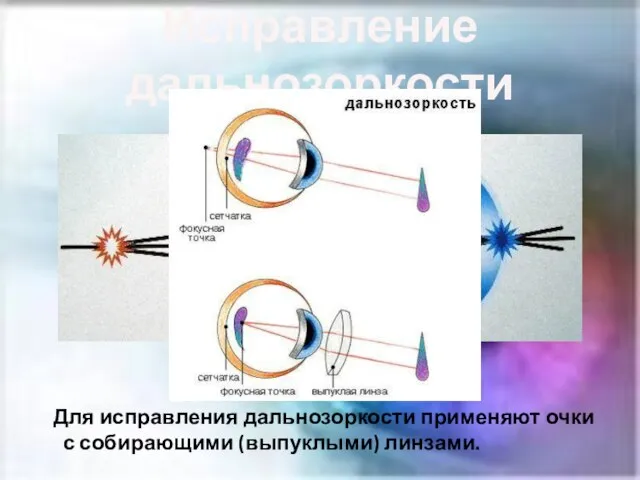 Исправление дальнозоркости Для исправления дальнозоркости применяют очки с собирающими (выпуклыми) линзами.