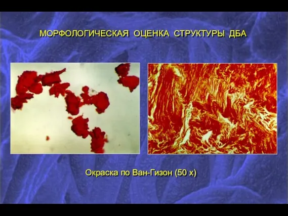 МОРФОЛОГИЧЕСКАЯ ОЦЕНКА СТРУКТУРЫ ДБА Окраска по Ван-Гизон (50 х)