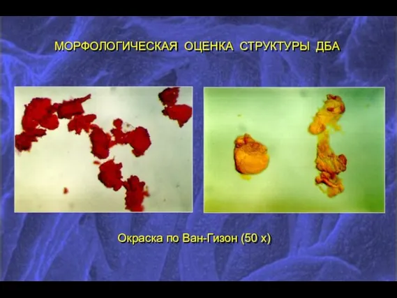 МОРФОЛОГИЧЕСКАЯ ОЦЕНКА СТРУКТУРЫ ДБА Окраска по Ван-Гизон (50 х)