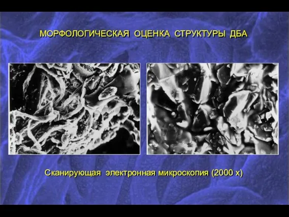 МОРФОЛОГИЧЕСКАЯ ОЦЕНКА СТРУКТУРЫ ДБА Сканирующая электронная микроскопия (2000 х)