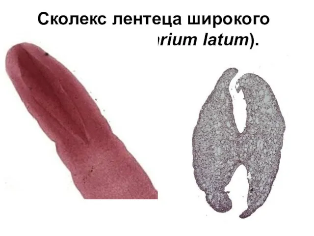 Сколекс лентеца широкого (Diphyllobothrium latum).