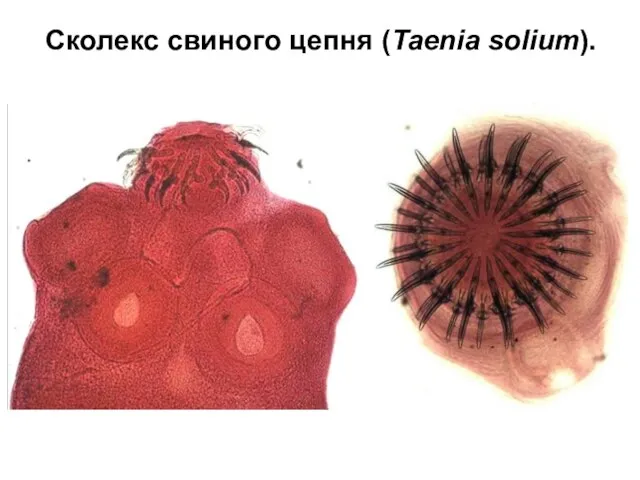 Сколекс свиного цепня (Taenia solium).
