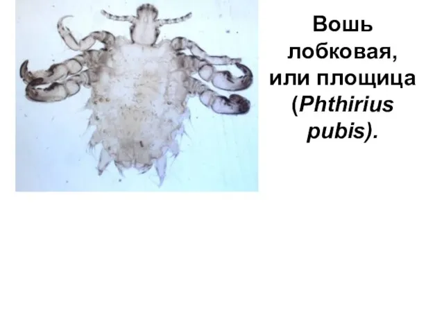 Вошь лобковая, или площица (Phthirius pubis).