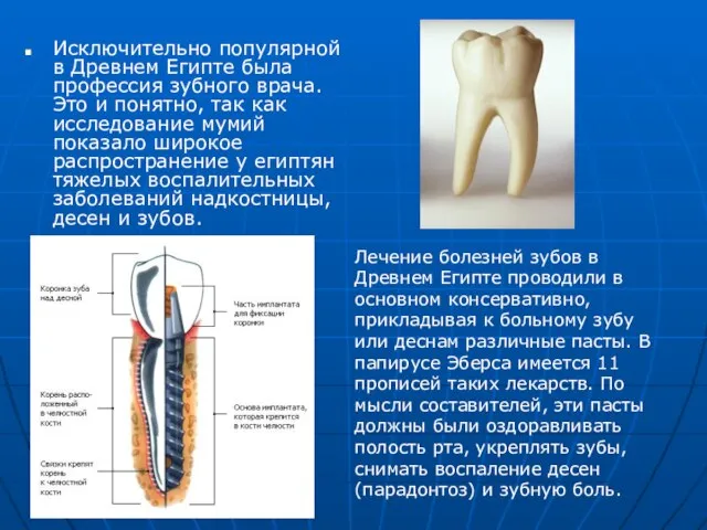 Исключительно популярной в Древнем Египте была профессия зубного врача. Это и понятно,