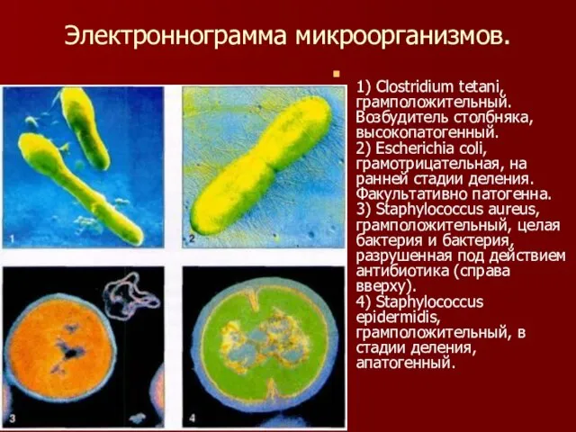 Электроннограмма микроорганизмов. 1) Clostridium tetani, грамположительный. Возбудитель столбняка, высокопатогенный. 2) Escherichia coli,