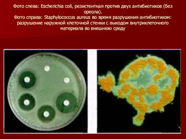 Фото слева: Escherichia соli, резистентная против двух антибиотиков (без ореола). Фото справа: