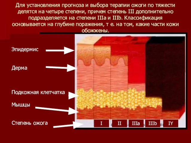 Для установления прогноза и выбора терапии ожоги по тяжести делятся на четыре