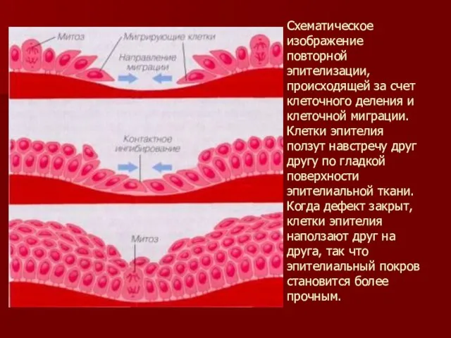 Схематическое изображение повторной эпителизации, происходящей за счет клеточного деления и клеточной миграции.