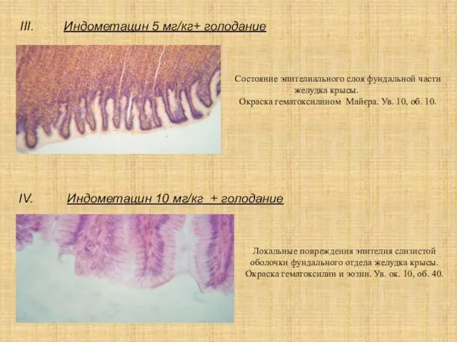 Индометацин 5 мг/кг+ голодание Состояние эпителиального слоя фундальной части желудка крысы. Окраска