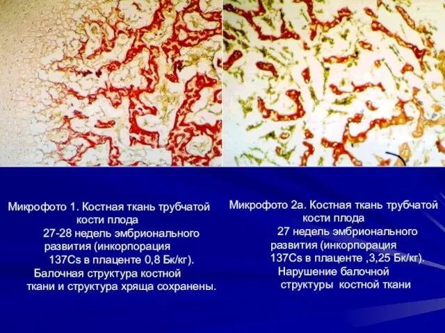 Микрофото 1. Костная ткань трубчатой кости плода 27-28 недель эмбрионального развития (инкорпорация