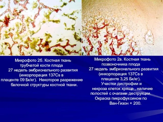 Микрофото 2б. Костная ткань трубчатой кости плода 27 недель эмбрионального развития (инкорпорация