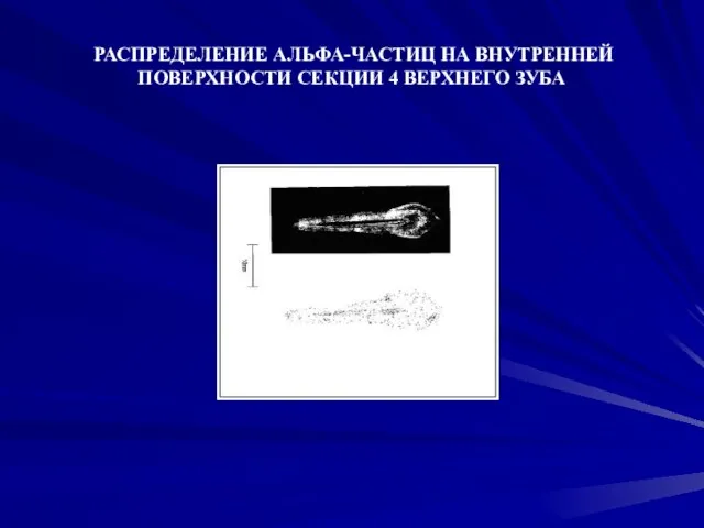 РАСПРЕДЕЛЕНИЕ АЛЬФА-ЧАСТИЦ НА ВНУТРЕННЕЙ ПОВЕРХНОСТИ СЕКЦИИ 4 ВЕРХНЕГО ЗУБА