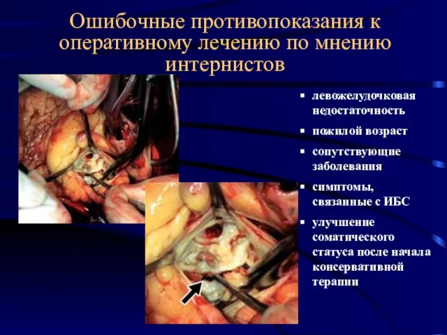 Ошибочные противопоказания к оперативному лечению по мнению интернистов левожелудочковая недостаточность пожилой возраст