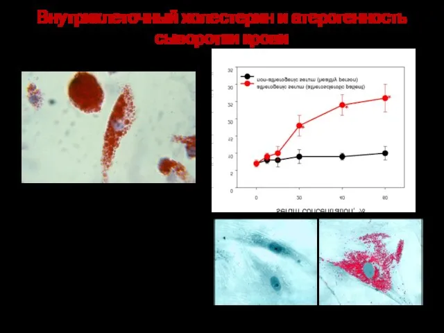 Внутриклеточный холестерин и атерогенность сыворотки крови пенистые клетки из атеросклеротической бляшки клетки