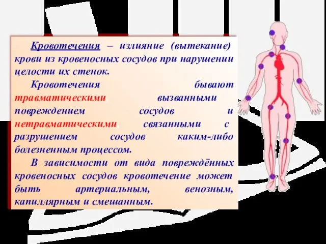 Кровотечения – излияние (вытекание) крови из кровеносных сосудов при нарушении целости их