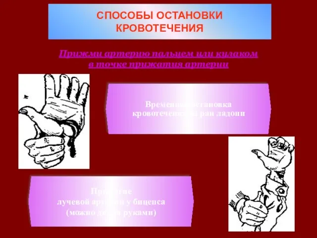 СПОСОБЫ ОСТАНОВКИ КРОВОТЕЧЕНИЯ Прижми артерию пальцем или кулаком в точке прижатия артерии