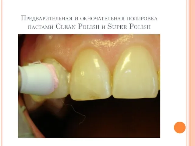 Предварительная и окночательная полировка пастами Clean Polish и Super Polish