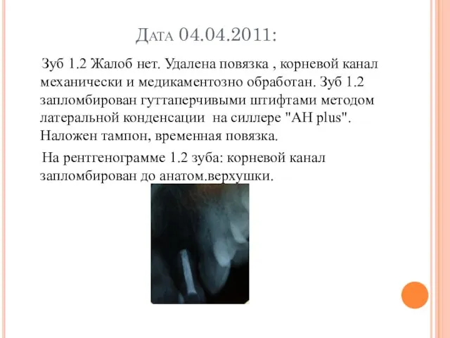 Дата 04.04.2011: Зуб 1.2 Жалоб нет. Удалена повязка , корневой канал механически