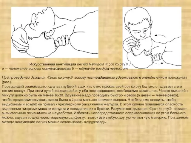 Искусственная вентиляция легких методом ≪рот ко рту≫: a — положение головы пострадавшего;