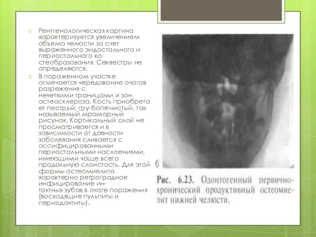 Рентгенологическая картина характеризуется увеличением объема челюсти за счет выраженного эндостального и периостального